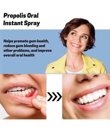 Furzero Propolis Oral Instant Treatment Spray - 30ml Propolis Mouthwash for Total Teeth Care - Herbal Oral Health Solution - Buy Online on GoSupps.com