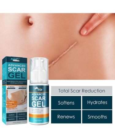 Scar Cream Gel for Skin Repair and Scar Removal - Improve Skin Scars - Buy Online on GoSupps.com