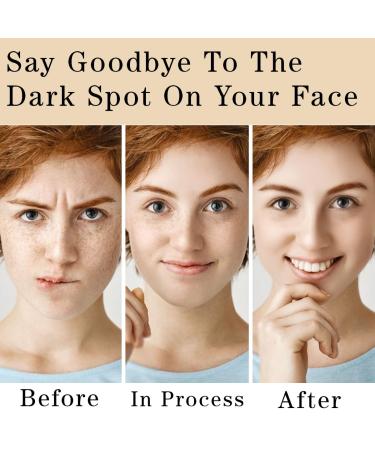 Dark Spot Corrector Cream - Remove Dark Spots on Face & Body | Collagen & Niacinamide | Instant Results | 2 oz - Buy Online on GoSupps.com