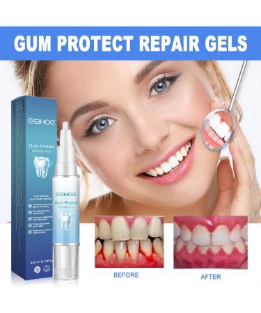 Gums Therapy Gel - Advanced Gum Shield & Tooth Whitening Essential (2 pcs) | Effective Gum Care & Oral Health Solution - Buy Online on GoSupps.com