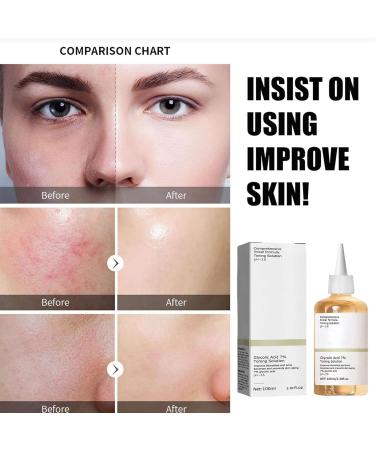 Glycolic Acid Toner Glycolic Acid 7% Toning Solution Glycolic Acid 7% Hydrating Serum Skin Glycolic Acid Serum Toner Skincare Hydrating Moisturiser Resurfacing Solution Brightening Serum Facial Serum - Buy Online on GoSupps.com