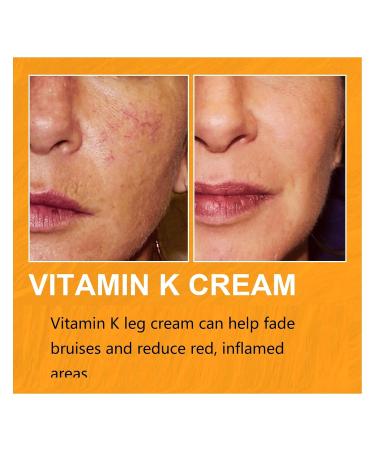 Varicose Veins Miracle Cream - Vitamin K Formula for Circulation | 2 PCS (30 Pack) - Effective Varicose Vein Relief - Buy Online on GoSupps.com