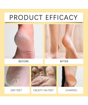 Honey Foot Cream Hand & Heel Cream for Very Dry Hands & Feet Foot Cream for Cracked Heels and Dry Skin Cracked Heel Repair Cream Foot Moisturiser Foot Care Products Cracked Heel Treatment Heel Cream - Buy Online on GoSupps.com