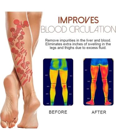 Gingerlegs Anti-Swelling Ointment Det_oxing Anti-Swelling Ointment Lymphcare Ginger Anti-Swelling Pomade Natural Lympunclog Ointment - Buy Online on GoSupps.com