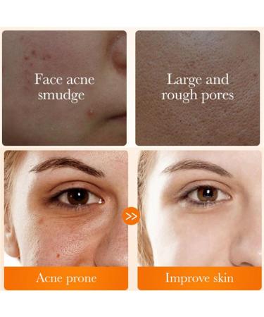 Turmeric Facial Cleanser | Brightening Foaming Face Wash with Kojic Acid | Gently Cleans Pores | 3 Pack - Buy Online on GoSupps.com