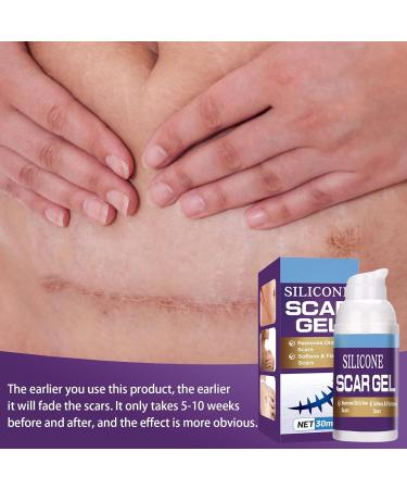 Effective Scar Cream for Old & New Scars | Smooth Skin Care - 30 ml | International Shipping Available - Buy Online on GoSupps.com