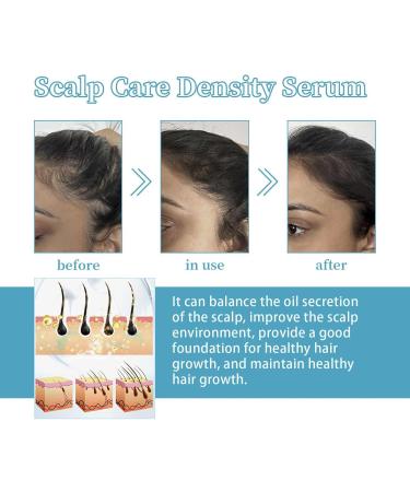 Hair Care Oil - 30ml Density Drop Scalp Oil for Hair Growth | To Moisturize Restore Prevent Breakage Loss Hair Fall Volume and Thickness - Buy Online on GoSupps.com