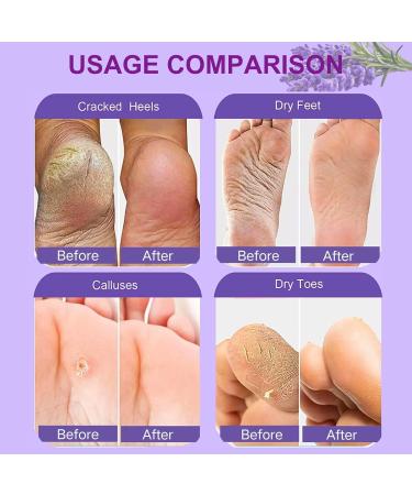 3 Pairs Exfoliating Foot Peel Mask Moisturizing Care Foot Mask Socks Foot Peel Socks Callus Remover for Feet Repair Heels Removes Dry Dead Skin Cracked Heel for Baby Soft Feet- Lavender - Buy Online on GoSupps.com