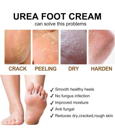 Urea 40% Foot Cream Urea Cream for Feet Cracked Heel Repair Cream Urea Cream 40 Percent Foot Moisturiser Cream Feet Hard Skin Remover Foot Callus Remover Nourishes Soften For Feet Knees Hand - Buy Online on GoSupps.com