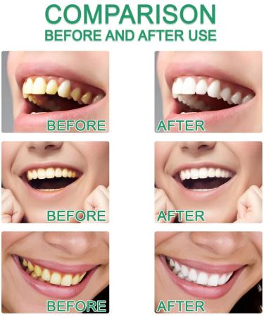 Spokesmany Toothpaste Niacinamide Toothpaste Niacinamide Intensive Whitening Toothpaste Xoermioy Niacinamide Whitening Toothpaste (2pcs) - Buy Online on GoSupps.com