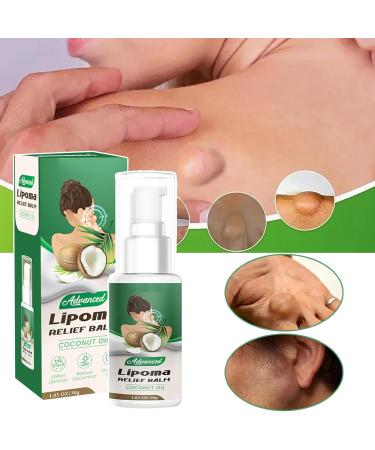  limination Des Lipomes 30g limination Douce Des Lipomes Pommade Apaisante pour la Peau Pour Visage Corps Articulations Jambe Bras Dos Routine Quotidienne Nuit Voyage Massage - Buy Online on GoSupps.com