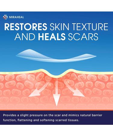 Silicone Scar Sheets 5.7x1.57 - Keloid & Surgical Scar Removal - Ultra-Thin & Breathable - 4 Reusable Patches - Buy Online on GoSupps.com