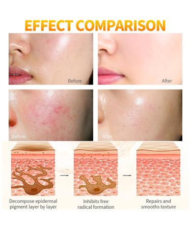 Moisturizing Repair Cream with Vitamin C & Arbutin | Anti-Aging Pore Shrinking | 120g - Buy Online on GoSupps.com