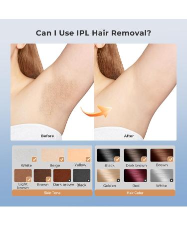 LUBEX 21J Laser Hair Removal Device - 3-in-1 IPL System for Women/Men - 9 Energy Levels - 999,900 Flashes - Perfect Hair Removal for Legs, Bikini, Face - Gold - Buy Online on GoSupps.com