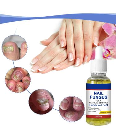 Nail Fungal Treatment Toenail Treatment Extra Strong Nail Repair Set Fingernail Toenail Care Fix Renew Damaged Broken Anti Fungus Nail Repair - Buy Online on GoSupps.com