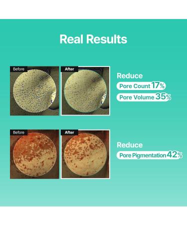 Porethera Real Bifida Blur Cream - Korean Face Moisturizer - Pore Minimizer Face Tone-Up Cream for Blurring Face - Pore Regenerating - Facial Moisturizer for Oily and Acne-Prone Skin, 1.69 fl.oz - Buy Online on GoSupps.com