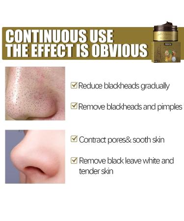 Pro-Herbal Refining Peel-Off Facial Mask Set - Blackhead Remover & Pore Cleansing Skincare - Buy Online on GoSupps.com