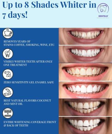 5D Teeth Whitening Strips - Enamel Safe for Sensitive Teeth - 14 Sessions - Buy Online on GoSupps.com