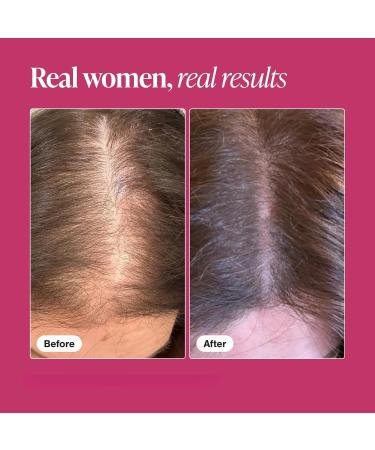 Womens hair growth supplement for thicker fuller hair nourishes thinning hair and hair loss - Buy Online on GoSupps.com