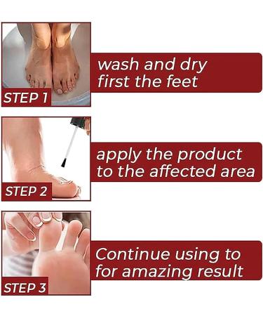 UIWLLOUC GFOUK Foot Corn Removal Gel 10ml - Extra Strength Liquid for Corn Removers - 2pcs - Buy Online on GoSupps.com