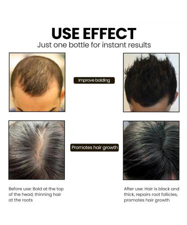  Miake Set of 2 Multiflorum-enriched anti-grey hair serums to naturally reverse grey hair regrowth for thicker and healthier-looking hair 30 ml - Buy Online on GoSupps.com