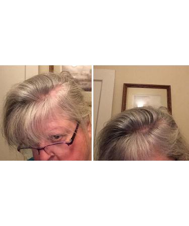 Caboki VALUE PACK 2 (3 x 30 gram plus one Volume Control Mist) 270-Day Supply Salt & Pepper Light - Buy Online on GoSupps.com