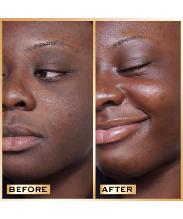 Miracle Serum - Hydrating Face Serum with Hyaluronic Acid & Niacinamide for Dullness & Uneven Skin Tone | 1 oz - International Shipping - Buy Online on GoSupps.com