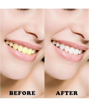 Xnivuis Interdental Brushes - 40 Pieces Multicolor Dental Cleaning Tools for Home & Travel | Effective Tooth Cleaning & Oral Hygiene - Buy Online on GoSupps.com