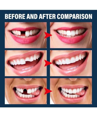 56 Pieces Full Acrylic False Teeth Dentures Kit - 2 Sets A2 Upper & Lower Dental Prosthesis for Replacement DIY or Halloween - Buy Online on GoSupps.com