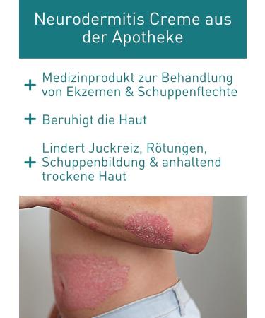 N1 Psoriasis Intensive Cream 100ml - Soothing Eczema & Neurodermatitis Treatment for Red Scaly Inflamed Skin - Relieves & Smoothes Dry Skin (1 Pack) - Buy Online on GoSupps.com