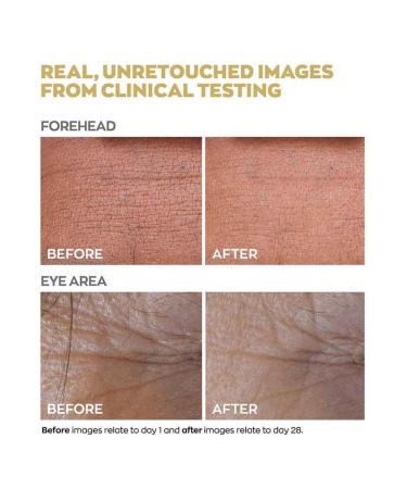 Anew Skin Renewal Power Serum - Dual-Collagen Boost & Protinol Technology | 30ml | Smooths Skin Reduces Pores & Minimizes Lines in 7 Days - Shop Now - Buy Online on GoSupps.com