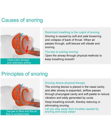 Snoring Solution Devices - Blue Breath Aids for Better Sleep - Buy Online on GoSupps.com