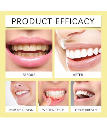 KLYso Natural Teeth Whitening and Freshness Powder - Gentle Stain Remover for Yellow Teeth Long - Lasting Oral Freshness(1PCS) - Buy Online on GoSupps.com