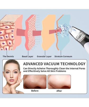 EORYNOL Blackhead Remover Pore Vacuum 2022 - Hot Compress Extractor with 6 Probes for Men & Women - Buy Online on GoSupps.com