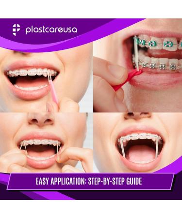 1000 Assorted Colors Orthodontic Elastic Bands for Braces | Medium 4.5 Oz Multi-Sized & Tension Dental Bands for Teeth Alignment | Latex Free | 10 Bags of 100 - Buy Online on GoSupps.com