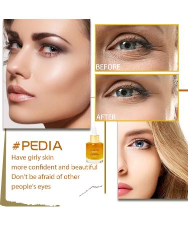 Pedia Collagen Boost Anti-Aging Serum - Vitamin C Skin Serum for All Skin Types | 1.01 Fl Oz | Unisex - Buy Online on GoSupps.com