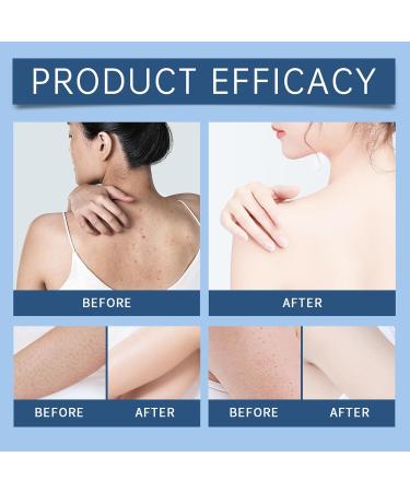 Dark Spot Correcting Cream - Skin Lightening Cream for Intimate Areas - Dark Spot Remover for Face and Body - Knees Elbows & Bikini Line Lotion claircissante 30 g - Buy Online on GoSupps.com