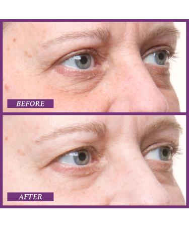 PRAI Beauty Ageless Eye D-Crease Cream - Revitalize & Smooth Eyes 15 ml - Buy Internationally - Buy Online on GoSupps.com
