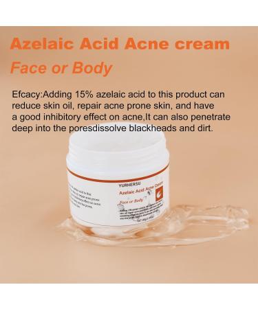 Azelaic Acid Acne Cream with Aloe Extract - Oil Control & Deep Cleaning for Sensitive Skin - Moisturizing Anti-Acne Skin Care - Buy Online on GoSupps.com