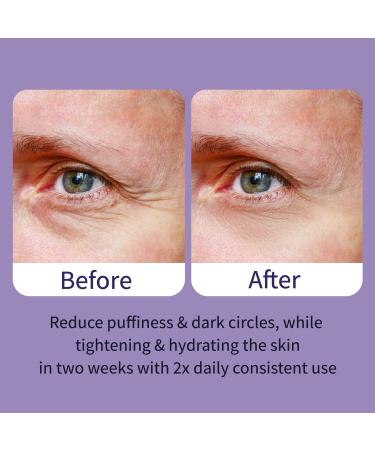 Ebanel Peptides Eye Serum for Dark Circles & Puffiness | Under Eye Treatment for Women & Men | Eye Lifting & Firming Serum with Wine, Lavender & Olive Leaf Extracts - Buy Online on GoSupps.com