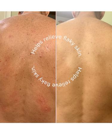 DRMTLGY 12% AHA Skin Lotion for Rough, Bumpy, KP, Dry Skin & Folliculitis - 6.9 Fl Oz - Buy Online on GoSupps.com