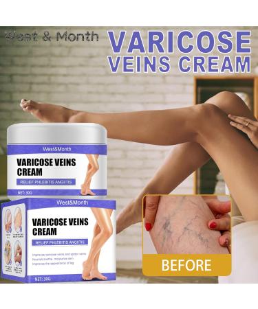 30g Varicose Vein Cream - Spider Vein Treatment & Phlebitis Skin Care Ointment for Improved Blood Circulation & Relief for Tired Legs - Buy Online on GoSupps.com