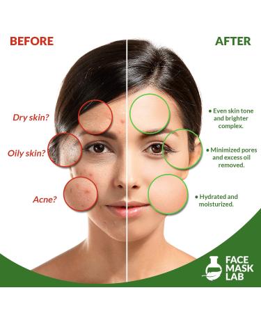 Face Mask Lab - Collagen Charcoal Peel Off Sheet Masks [20 Pack] - Hydrating Facial Skin Care for Dry, Oily, or Acne Skin - Buy Online on GoSupps.com