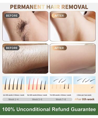 IPL Laser Hair Removal Device for Women and Men | Painless Hair Remover for Whole Body | 999,999 Flashes | Corded At-Home Treatment - Buy Online on GoSupps.com