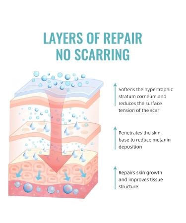 Advanced Scar Cream Gel - Effective Scar Removal for Surgical Scars Burns Acne C-Sections & More | Suitable for All Skin Types - 1.06 Oz - Buy Online on GoSupps.com