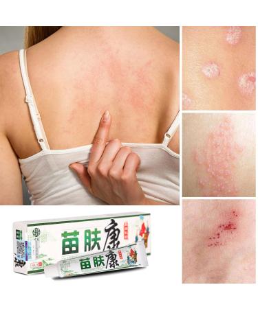 Herbal Anti-Itch Cream for Psoriasis, Dermatitis, Eczema - Multicolor, One Size - Buy Online on GoSupps.com