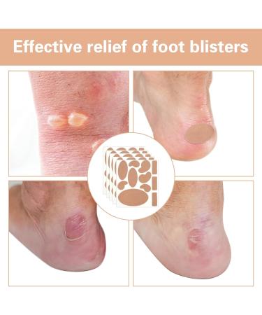 132Pcs Moleskin Pads for Feet Adhesive Blister Prevention Pad Waterproof Flannel Blister Tape Anti-Wear Heel Patch Bandages for Outdoor Long Trips Hiking Mountaineering (12 Sheets 11 Shapes) - Buy Online on GoSupps.com