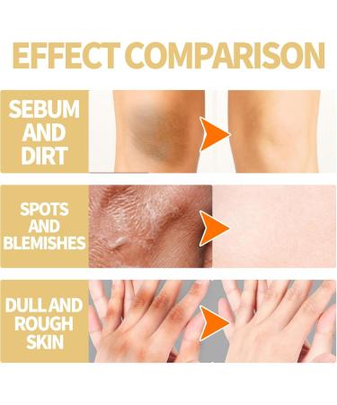 KOAHDE Super Strength Peeling Oil Removing Exfoliating Oil Bright White Exfoliating Oil Remove Exfoliating Moisturizing Oil Natural Spots Whitening Peeling Oil Yellow Peeling Oil All Types 50ML - Buy Online on GoSupps.com