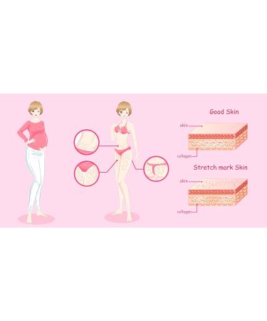 Blue & Navy Bretania - Pro Stretch Mark Cream | Preventive & Repair | Natural | Clinically Tested | Pregnancy & Postpartum | Fast 200 ml - Buy Online on GoSupps.com