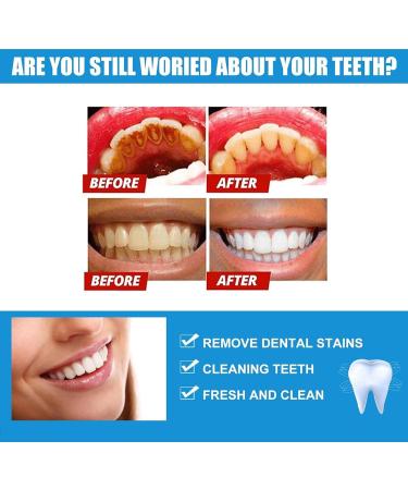 Gum Repair Gel Gum Protect Repair Gel Teeth Whitening Essence Pen Oral Care Formula Fresh Breath (2) - Buy Online on GoSupps.com